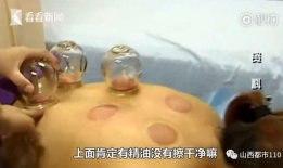 拔罐视频,揭秘拔罐神奇疗效的瞬间